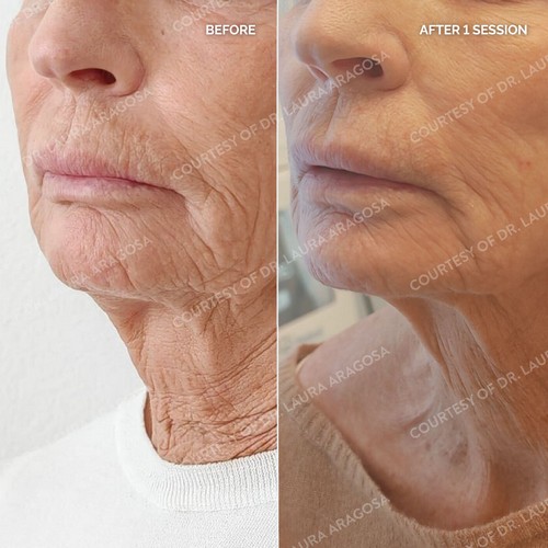 Post27_M6_INT_BeforeAfter_Cfu