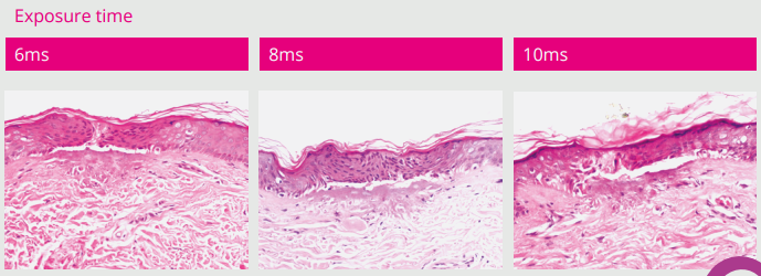 mesotix_treatmentversatility