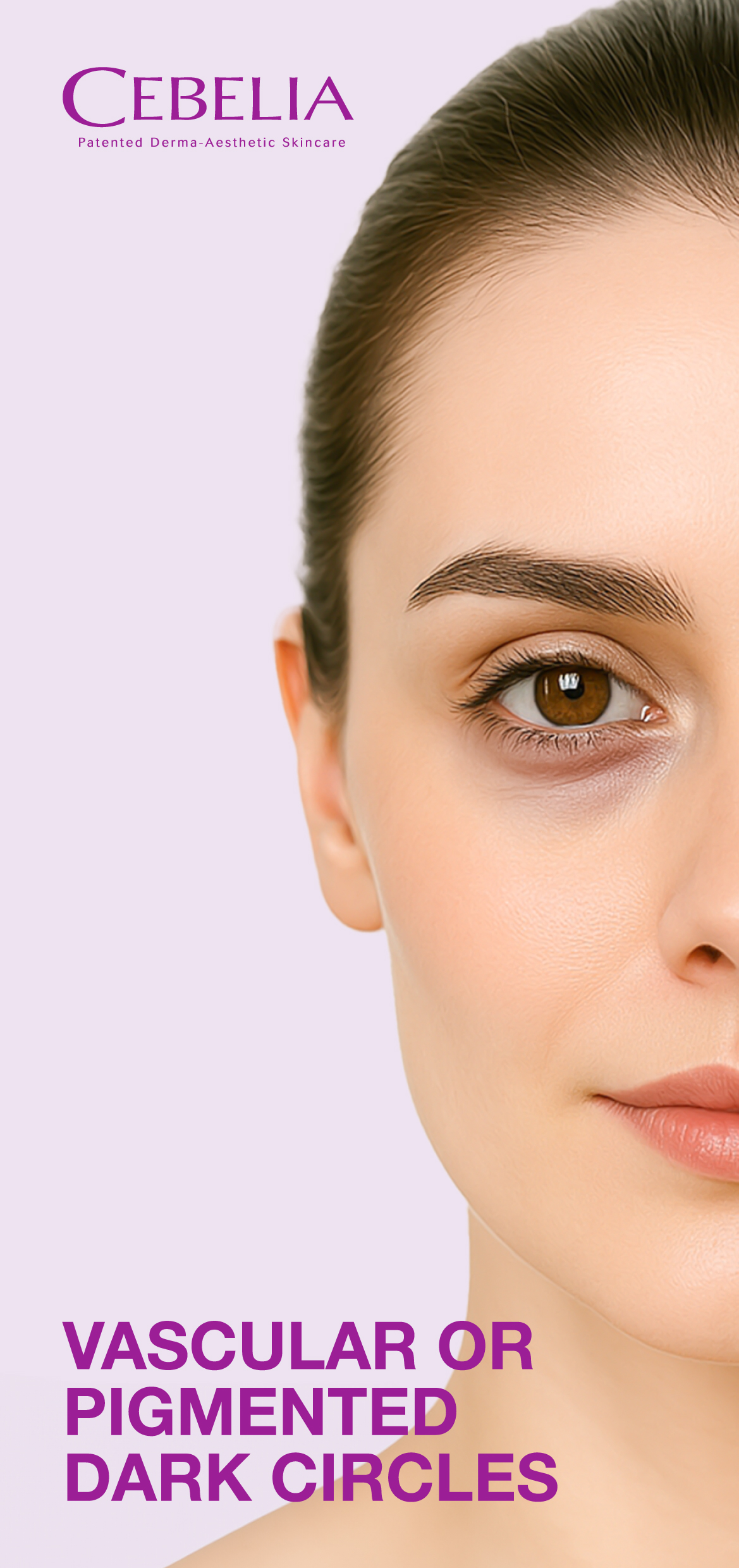 Cebelia_Dark_Circles_Main