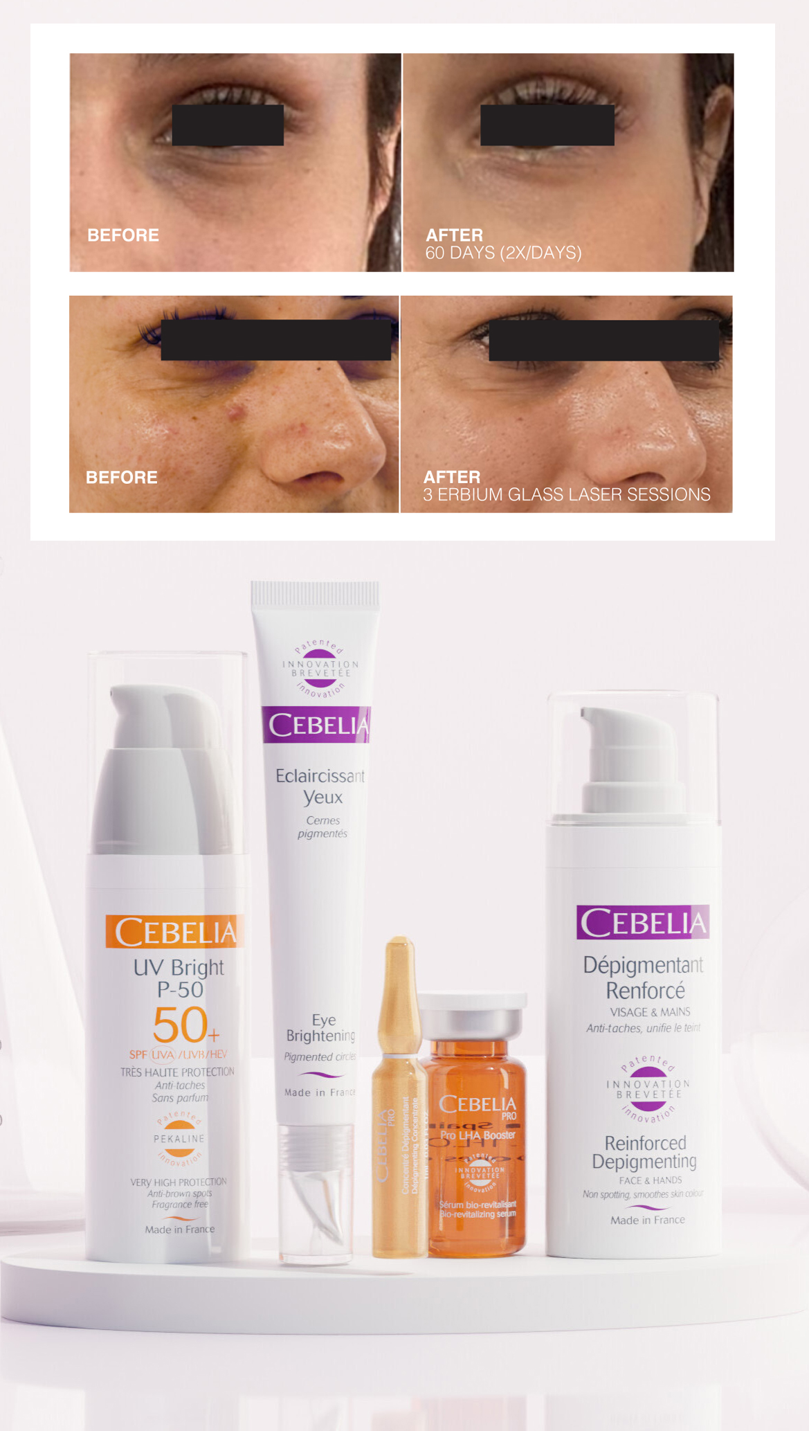 Cebelia_depigmentation_results