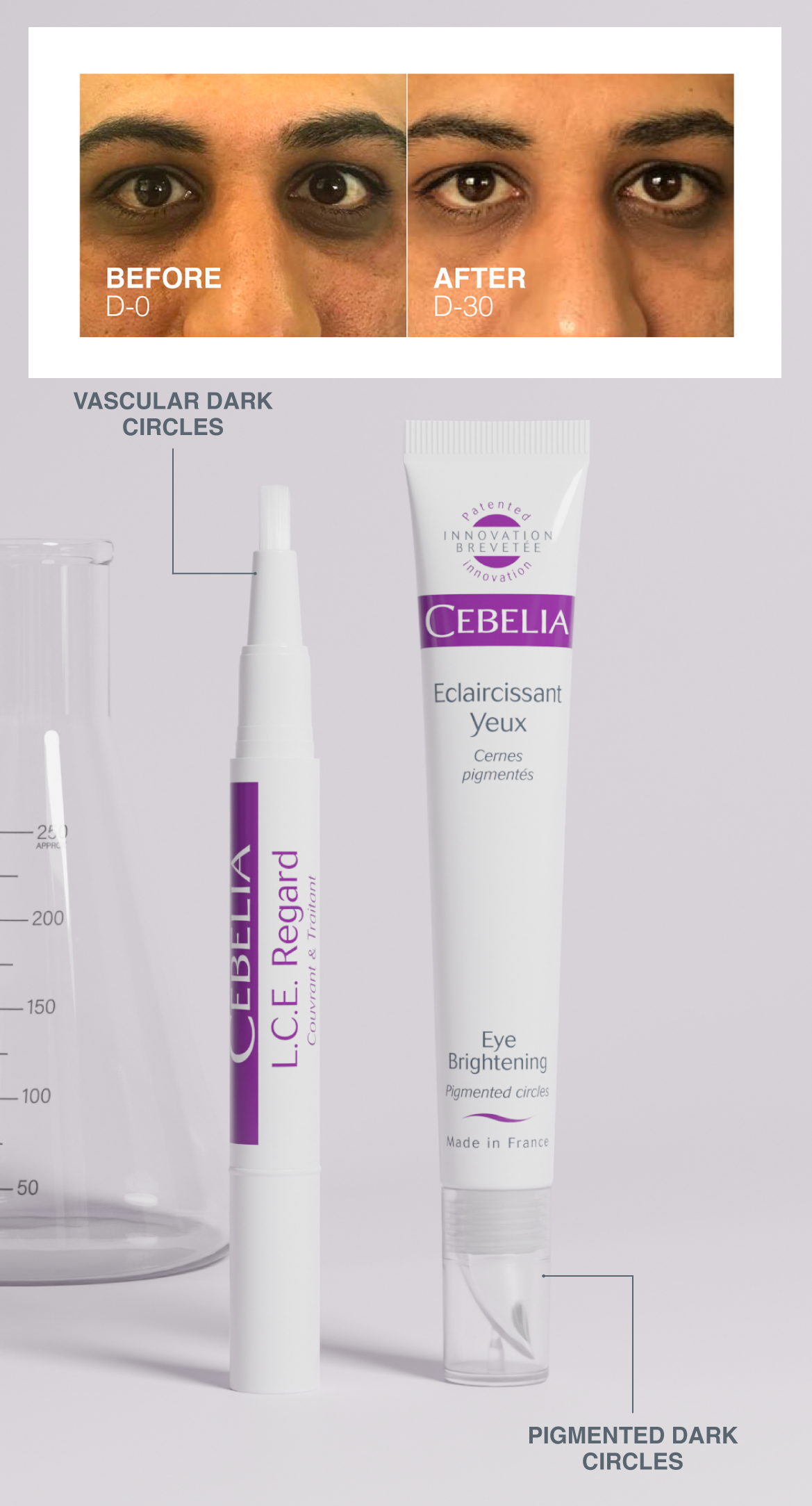 Cebelia_Dark_Circles_Result