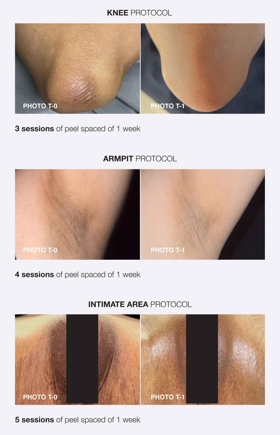 Celeblia_Intimate_Pigmentation_Results