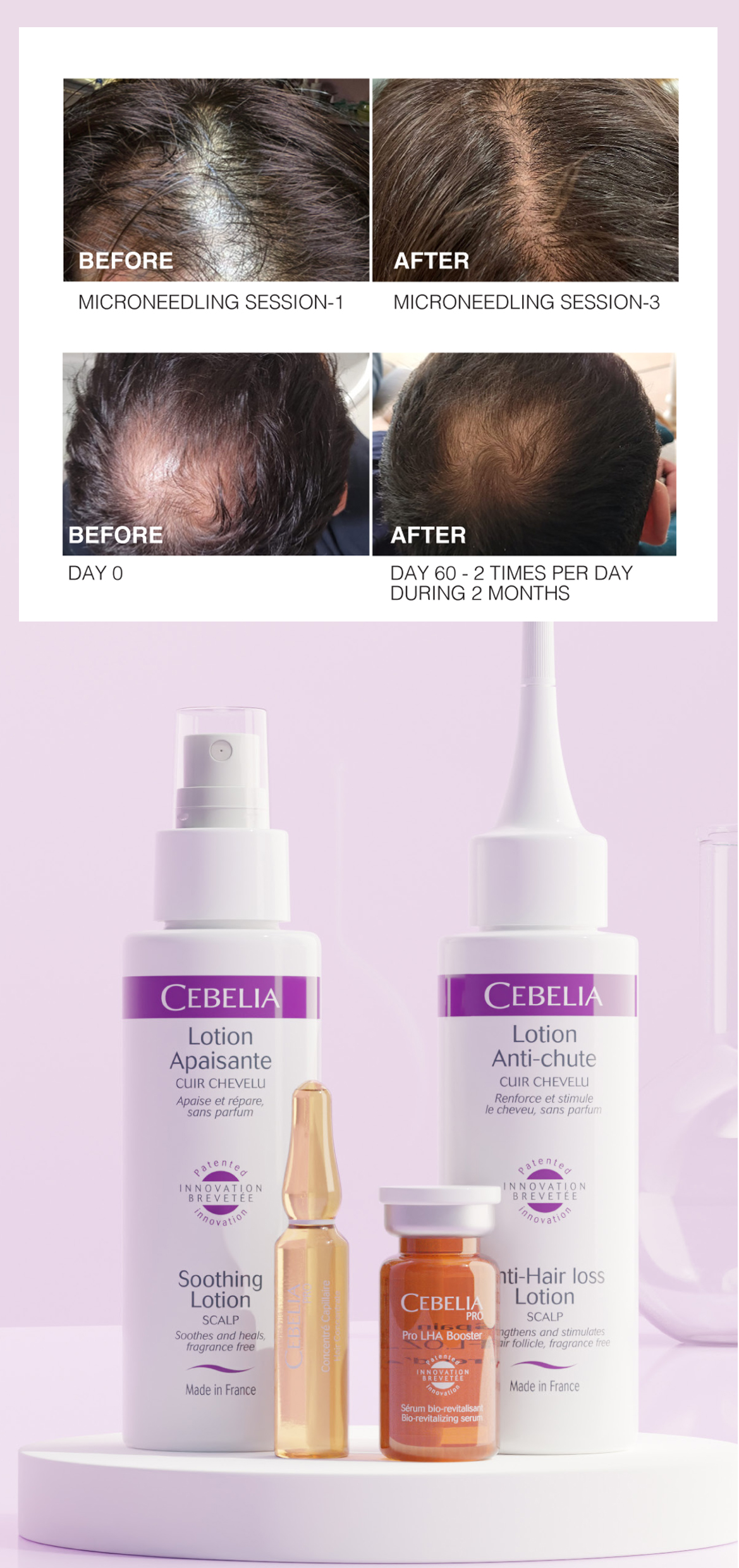 Celeblia_Intimate_Pigmentation_Results